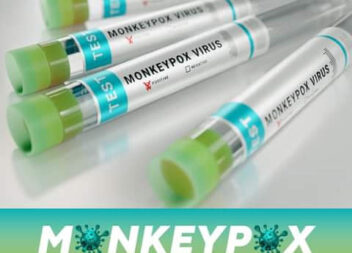 Varíola-dos-macacos já chegou à região Centro e Alentejo