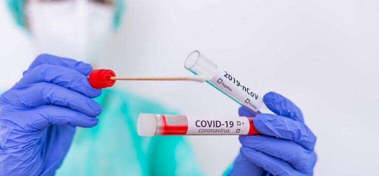 Transmissão da Covid-19 diminuiu e a média diária de casos encontra-se estável