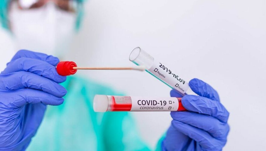 Transmissão da Covid-19 diminuiu e a média diária de casos encontra-se estável