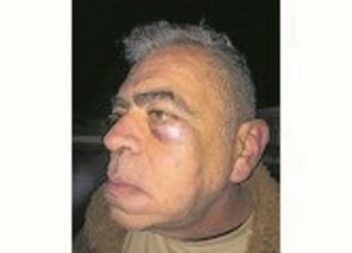 Oleiros: Militar da GNR acusado de espancar pai e filho na Passagem de Ano