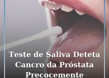 Novo Teste de Saliva Pode Detetar Cancro da Próstata Antes de Surgirem Sintomas
