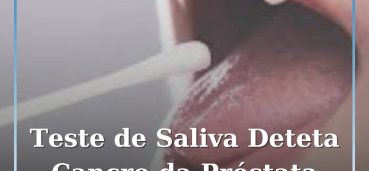 Novo Teste de Saliva Pode Detetar Cancro da Próstata Antes de Surgirem Sintomas