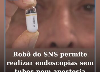 Robô do SNS permite realizar endoscopias sem tubos nem anestesia