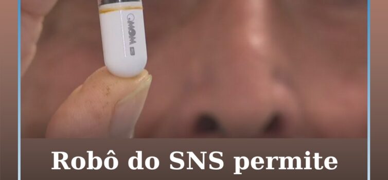 Robô do SNS permite realizar endoscopias sem tubos nem anestesia