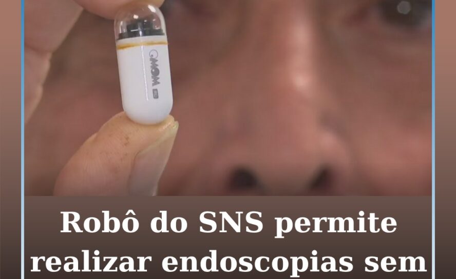 Robô do SNS permite realizar endoscopias sem tubos nem anestesia