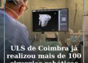 ULS de Coimbra ultrapassa 100 cirurgias robóticas de ortopedia