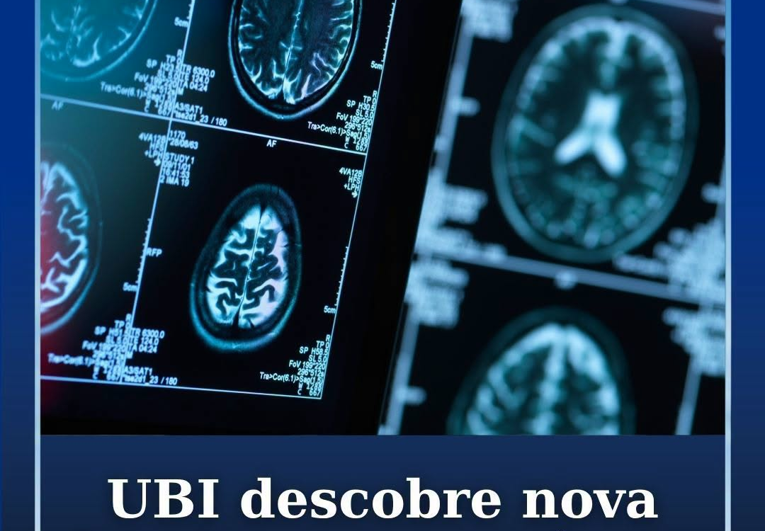 UBI descobre nova abordagem terapêutica para o AVC