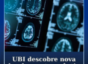 UBI descobre nova abordagem terapêutica para o AVC