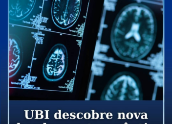 UBI descobre nova abordagem terapêutica para o AVC