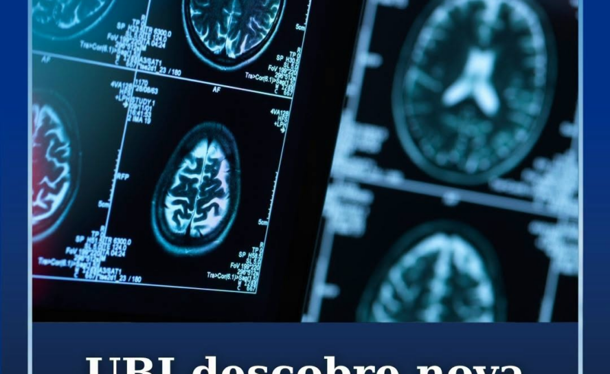 UBI descobre nova abordagem terapêutica para o AVC