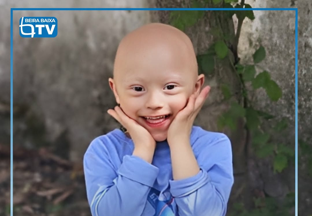 É o menino de sorriso fácil e meigo, que adora água e fotografias.