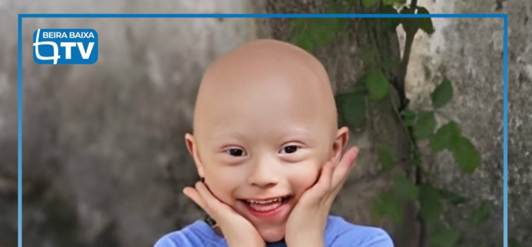 É o menino de sorriso fácil e meigo, que adora água e fotografias.