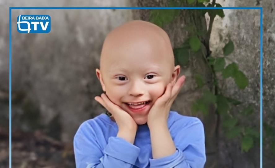 É o menino de sorriso fácil e meigo, que adora água e fotografias.